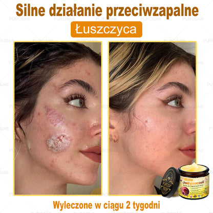 Utolsó esély! Már csak 5 tégely maradt a PUROSA® szuper kedvezményes ajánlatából! Most extra 50% kedvezménnyel teheted meg az első lépést a feszesebb és fiatalosabb bőr felé. Ha lemaradsz az idei akcióról, lehet, hogy soha többé nem találkozol hasonlóval!