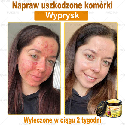 Utolsó esély! Már csak 5 tégely maradt a PUROSA® szuper kedvezményes ajánlatából! Most extra 50% kedvezménnyel teheted meg az első lépést a feszesebb és fiatalosabb bőr felé. Ha lemaradsz az idei akcióról, lehet, hogy soha többé nem találkozol hasonlóval!
