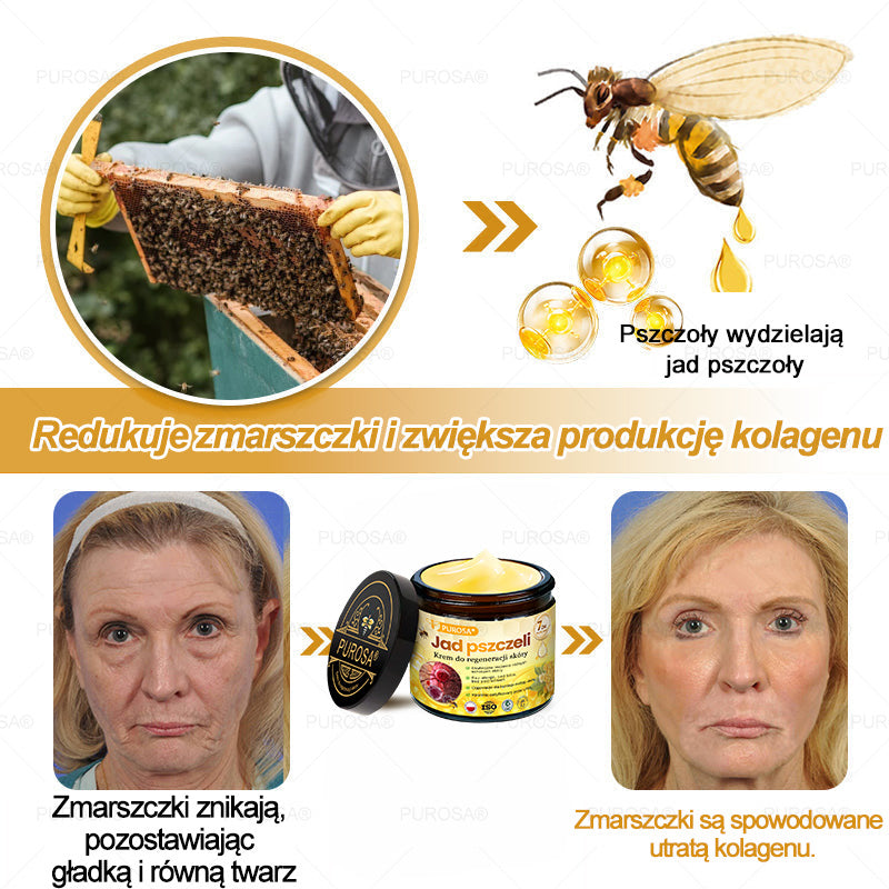 Utolsó esély! Már csak 5 tégely maradt a PUROSA® szuper kedvezményes ajánlatából! Most extra 50% kedvezménnyel teheted meg az első lépést a feszesebb és fiatalosabb bőr felé. Ha lemaradsz az idei akcióról, lehet, hogy soha többé nem találkozol hasonlóval!