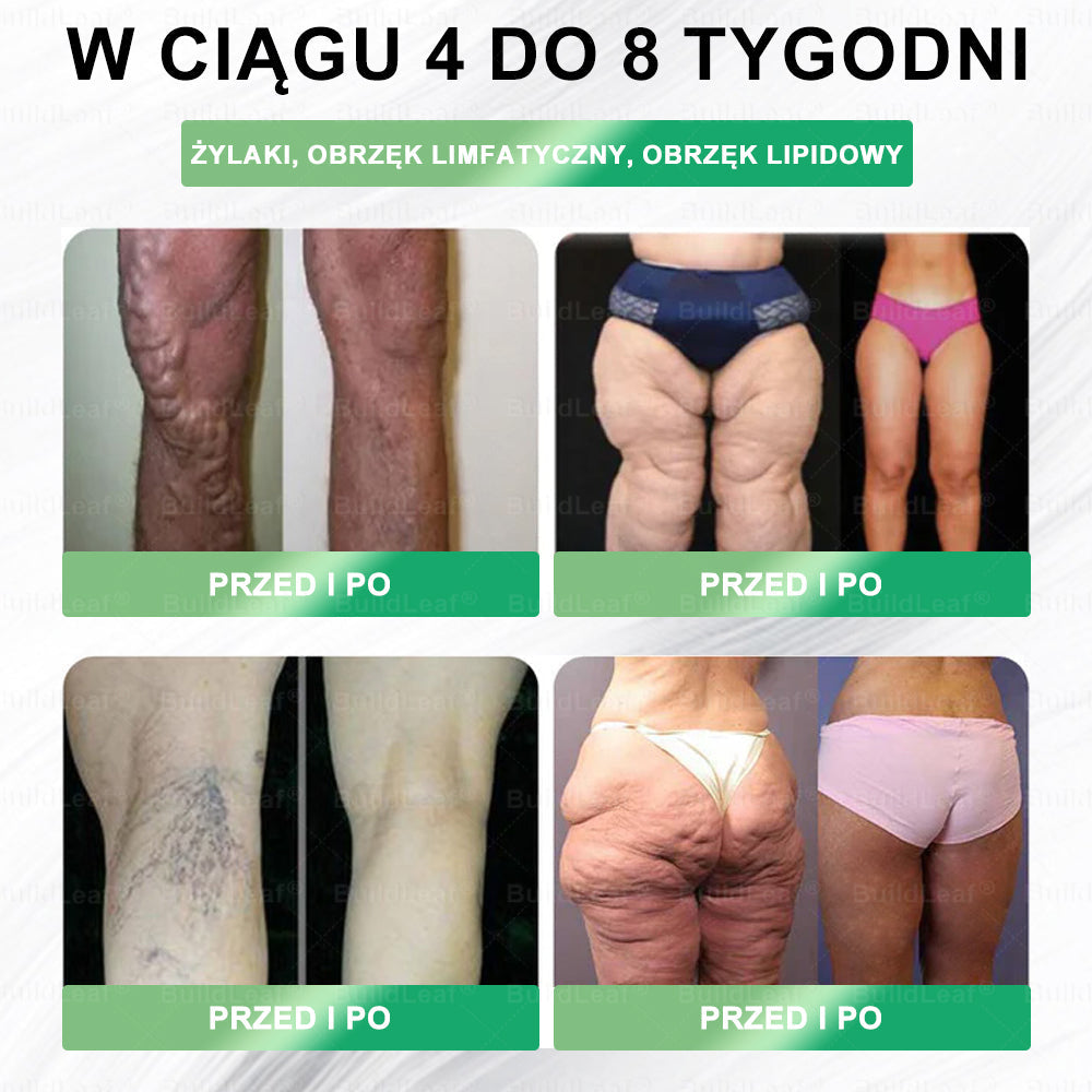 Oficjalny sklep Polska | ☘️☘️BuildLeaf® GLP-1 8-w-1 Fit & Vital roztwór doustny (Jednorazowe dziennie, widoczne zmiany w ciągu 7 dni) ✅ Otyłość, zdrowie sercowo-naczyniowe, cukrzyca, bezdech senny, zdrowie jelit, problemy ze stawami i inne.