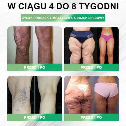 Oficjalny sklep Polska | ☘️☘️BuildLeaf® GLP-1 8-w-1 Fit & Vital roztwór doustny (Jednorazowe dziennie, widoczne zmiany w ciągu 7 dni) ✅ Otyłość, zdrowie sercowo-naczyniowe, cukrzyca, bezdech senny, zdrowie jelit, problemy ze stawami i inne.