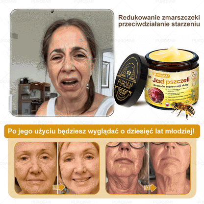 Utolsó esély! Már csak 5 tégely maradt a PUROSA® szuper kedvezményes ajánlatából! Most extra 50% kedvezménnyel teheted meg az első lépést a feszesebb és fiatalosabb bőr felé. Ha lemaradsz az idei akcióról, lehet, hogy soha többé nem találkozol hasonlóval!