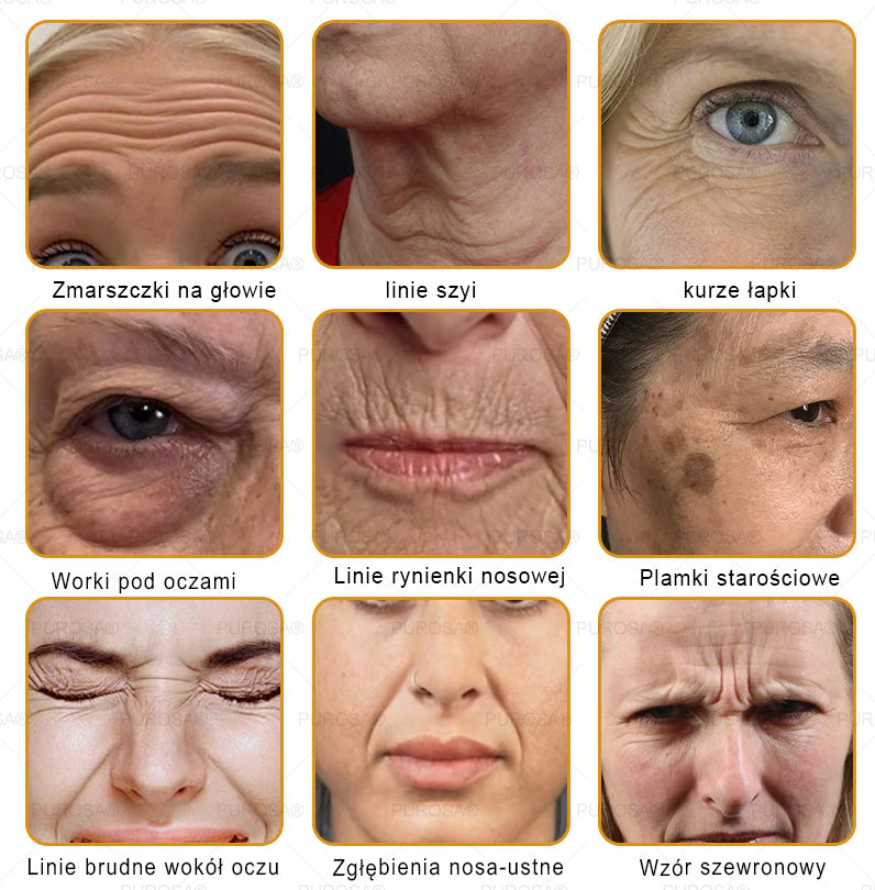 Utolsó esély! Már csak 5 tégely maradt a PUROSA® szuper kedvezményes ajánlatából! Most extra 50% kedvezménnyel teheted meg az első lépést a feszesebb és fiatalosabb bőr felé. Ha lemaradsz az idei akcióról, lehet, hogy soha többé nem találkozol hasonlóval!