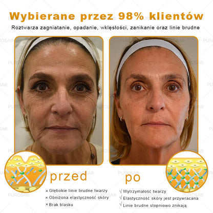 Utolsó esély! Már csak 5 tégely maradt a PUROSA® szuper kedvezményes ajánlatából! Most extra 50% kedvezménnyel teheted meg az első lépést a feszesebb és fiatalosabb bőr felé. Ha lemaradsz az idei akcióról, lehet, hogy soha többé nem találkozol hasonlóval!